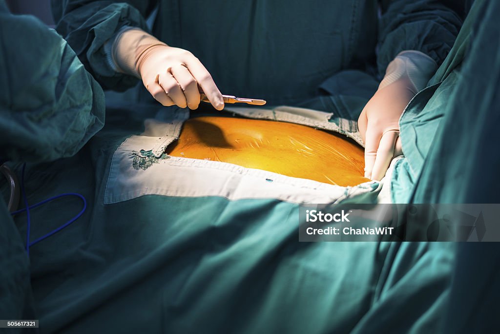 흉골절개술 절개 중앙값 - 로열티 프리 가정의 방 스톡 사진