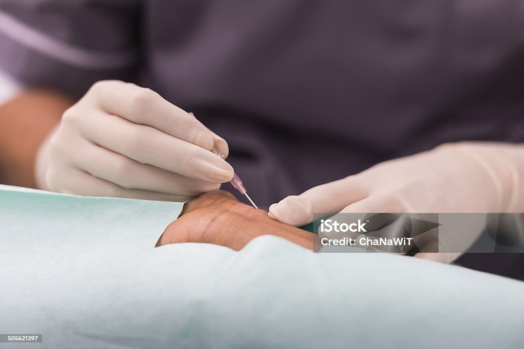 puncture  radial artery for arterial line monitor Syringe Stock Photo