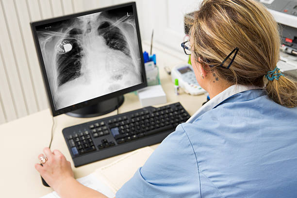 pielęgniarka w pracy, oglądając zdjęcia na monitorowanie badania rentgenowskiego - x ray chest human lung rib cage zdjęcia i obrazy z banku zdjęć