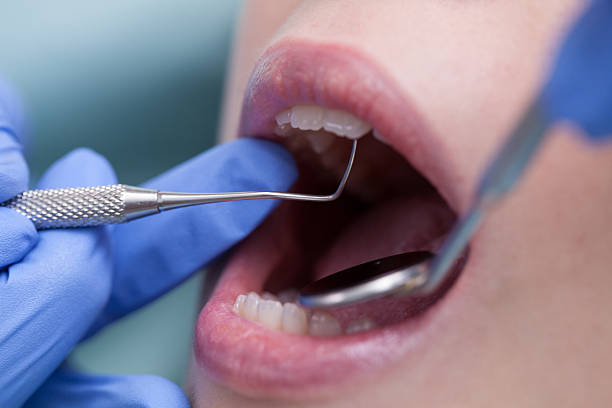 istock Young woman at the dental office. 505960962