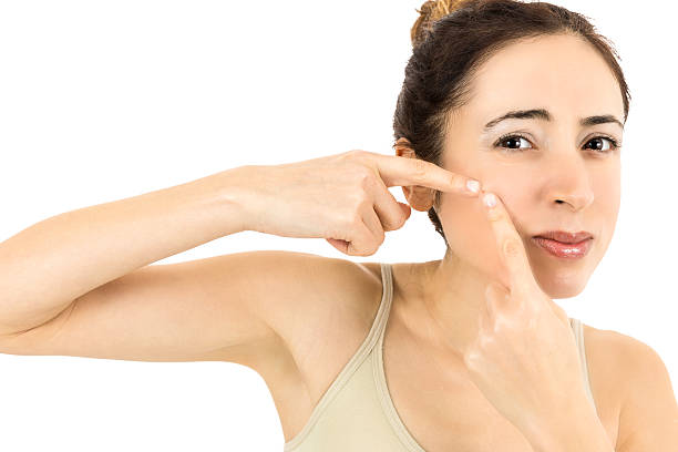 istock Woman with skin problem 505972860
