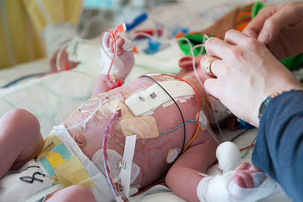 Child intensive care, mother and son. Postoperative care. Mother caring and helping her new born child after heart surgery. heart surgery photos stock pictures, royalty-free photos & images