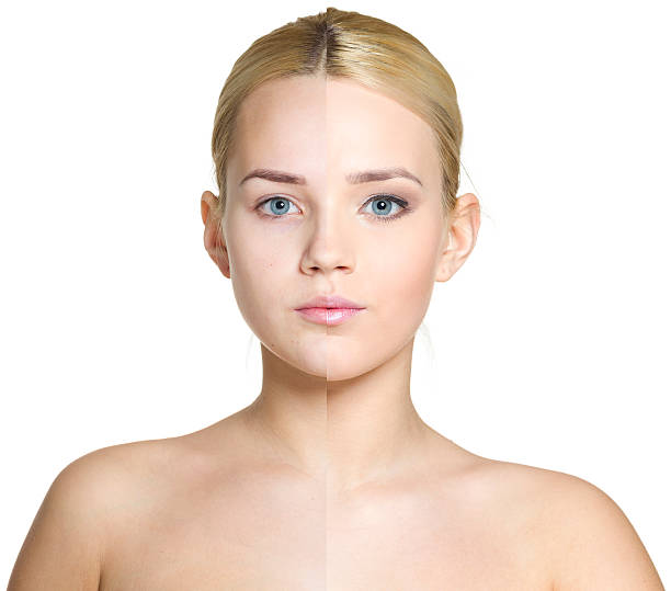 istock Woman before and after cosmetic treatment 505996128