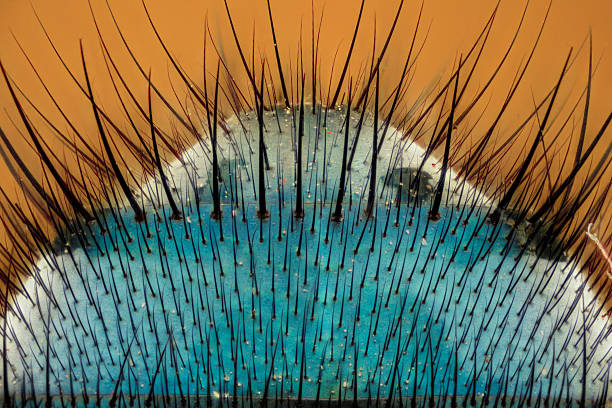 Extreme magnification - Fly body detail