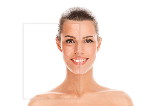 la peau avant et après retouche - people smiling variation multiple image photos et images de collection