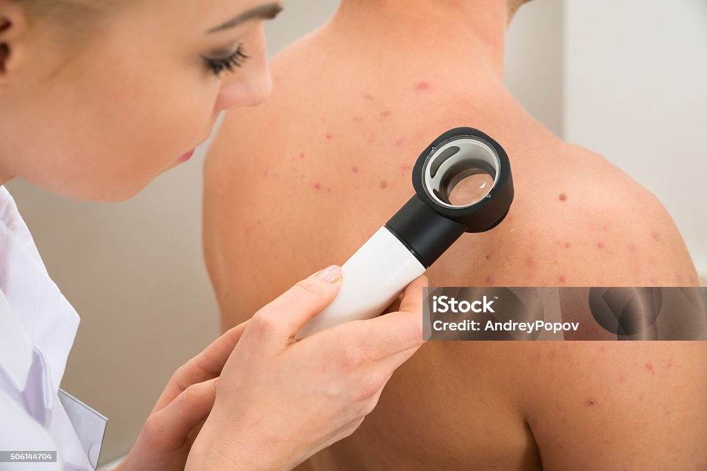 Doctor Examining Pigmented Skin Female Doctor Examining Pigmented Skin With Dermatoscope Melanoma Stock Photo