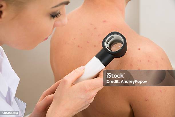 Doctor Examining Pigmented Skin Stock Photo - Download Image Now - Melanoma, Skin Condition, Beauty Treatment
