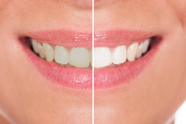 istock Close-up Of Woman Teeth 506145480