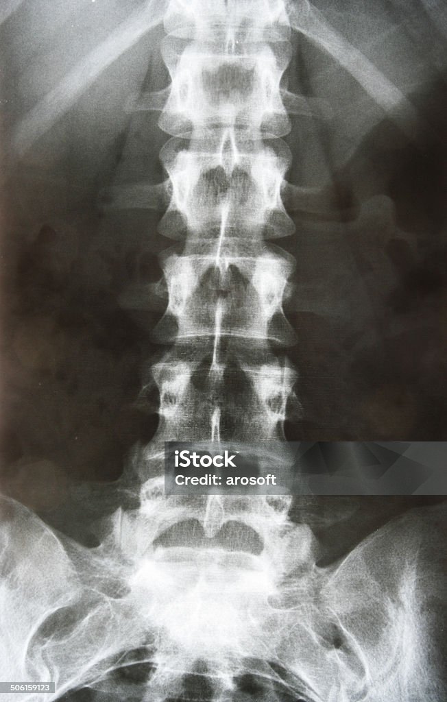X-ray - Foto de stock de Anatomía libre de derechos