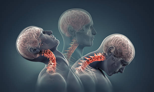 man x-ray with neck bones highlighted - menselijke nek stockfoto's en -beelden