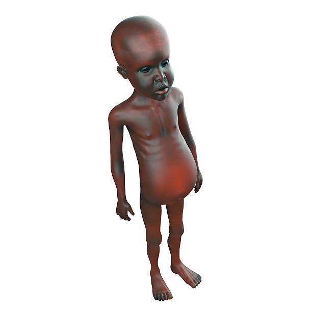 3d Starving African child suffering malnutrition 3d render of a starving African child suffering from malnutrition child malnutrition stock pictures, royalty-free photos & images