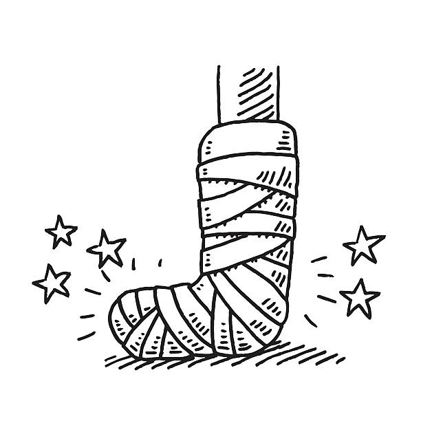 Broken Leg Injury Bandage Drawing Hand-drawn vector drawing of a Broken Leg Injury with a Bandage. Black-and-White sketch on a transparent background (.eps-file). Included files are EPS (v10) and Hi-Res JPG. fractured foot drawing stock illustrations