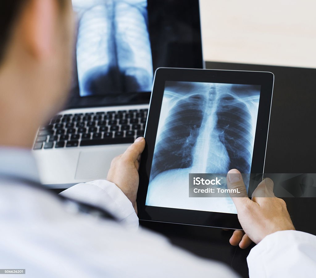 Doctor Using Digital Tablet Viewing Medical Scan Doctor holding a digital tablet with x-ray image into camera. Digital Tablet Stock Photo