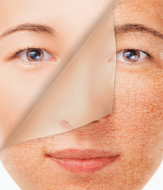 istock Smiling woman with new smooth skin 506694535