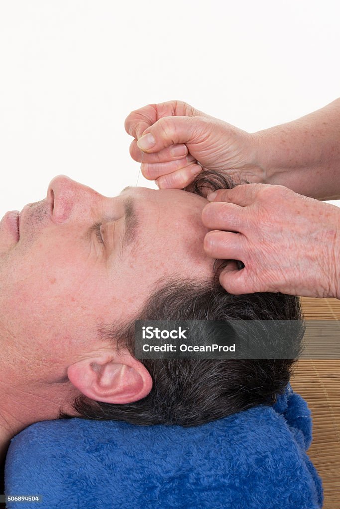 Close-up of man undergoing acupuncture treatment at Spa Alternative Therapy Stock Photo