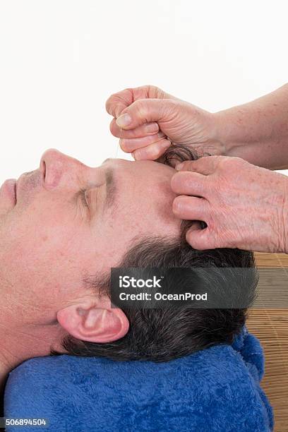 Closeup Of Man Undergoing Acupuncture Treatment At Spa Stock Photo - Download Image Now