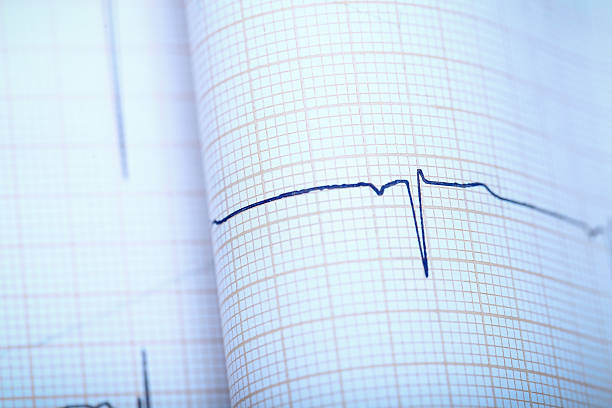 istock Close-up of heart complex on ECG paper 506900206