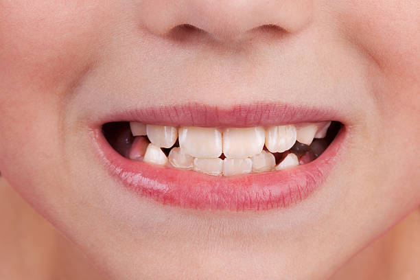 istock Face of a child with an open mouth and teeth 506920478