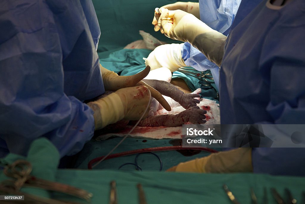 Caesarean Section Doctors on the operation of caesarean section Newborn Stock Photo