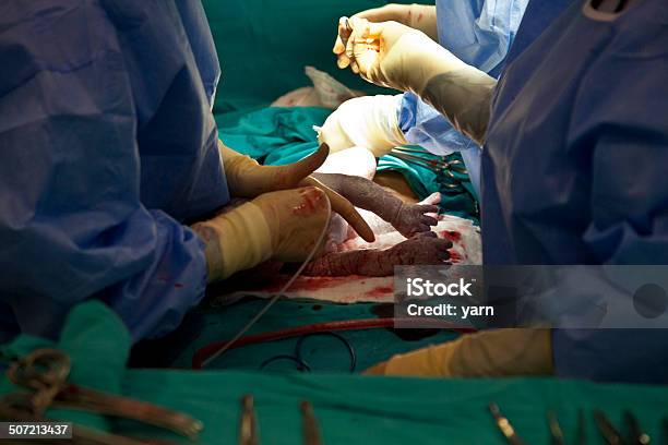 Caesarean Section Stock Photo - Download Image Now - Newborn, Accidents and Disasters, Baby - Human Age