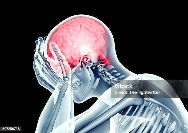 Xray Image Human Head With Pain Stock Photo - Download Image Now - Human Skeleton, Worried, Inflammation