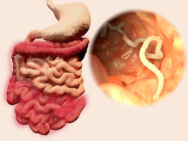 Tapeworm in the gastrointestinal tract stock photo