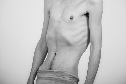 Young man with anorexia nervosa problem. White background.