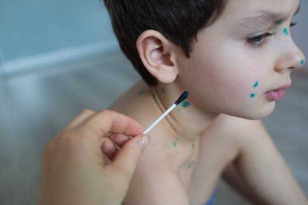 istock Mother draws a green points on a child skin 507304436