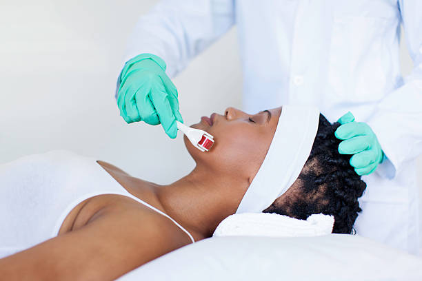 istock African patient getting micro-needling treatment by her doctor 507396659