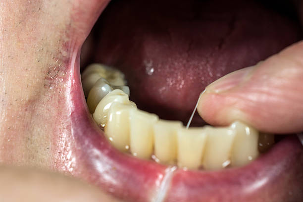 istock Senior Health Care- Teeth 507398503