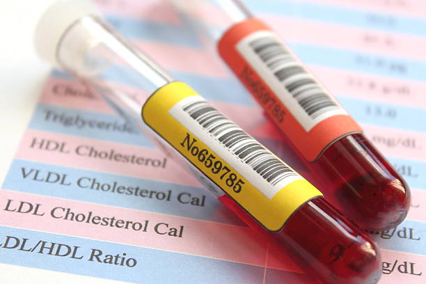 pobranie próbki krwi - cholesterol zdjęcia i obrazy z banku zdjęć