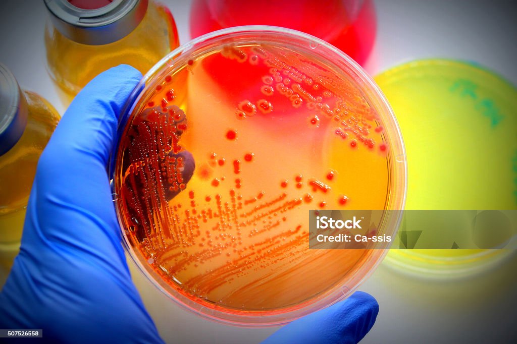 Microbiological examination Microbiological examination. Microbiology Stock Photo