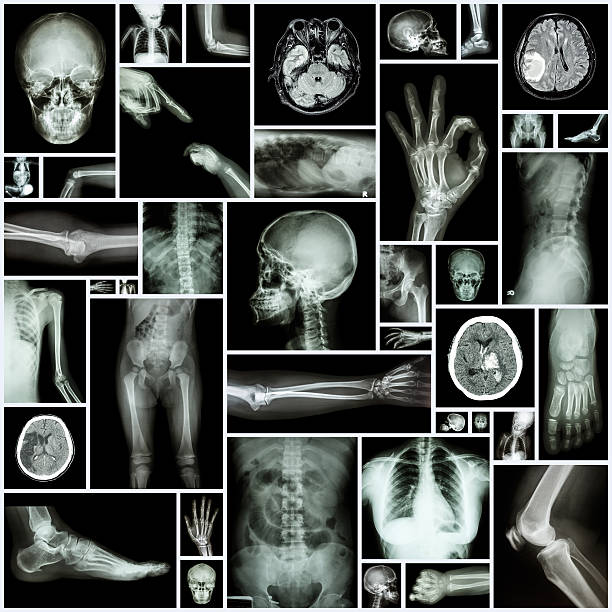 x 線複数の部品の人間 - cat scan pelvis hip human spine ストックフォトと画像