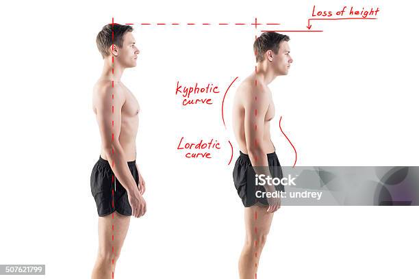 Man With Impaired Posture Position Defect Scoliosis And Ideal Bearing Stock Photo - Download Image Now