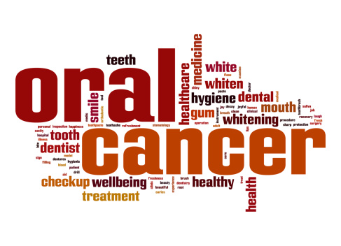 Oral cancer word cloud image with hi-res rendered artwork that could be used for any graphic design.