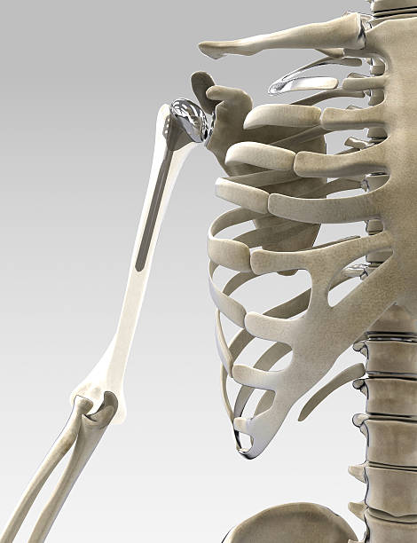 3 d braço e ombro prótese ilustração - pain rib cage x ray image chest imagens e fotografias de stock