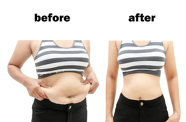 after a diet stock photo