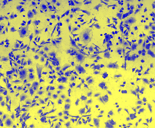istock HeLa cervical cancer cells 507878184