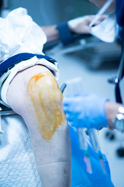 260+ Arthroscopic Knee Surgery Stock Photos, Pictures & Royalty-Free Images - IStock