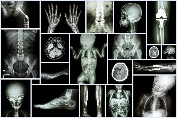 rayos x de varios órganos adultos y un niño. - cat scan abdomen medical scan x ray fotografías e imágenes de stock