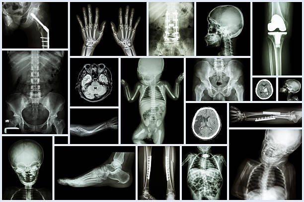 coleção raio-x vários adulto e da criança órgão - cat scan pelvis hip human spine - fotografias e filmes do acervo