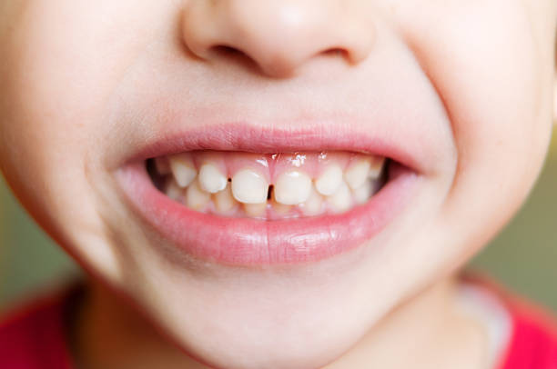 Kid's teeth stock photo