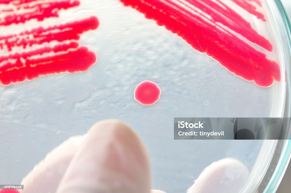 Petri dish with bacteria Petri dish filled with bacterial growth media are used to culture bacteria in the laboratory Agar Jelly Stock Photo