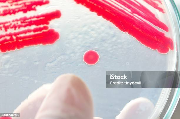 Petri Dish With Bacteria Stock Photo - Download Image Now - Agar Jelly, Bacterium, Biology