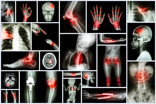 coleção de v�ários órgãos humanos de raios x - cat scan pelvis hip human spine - fotografias e filmes do acervo