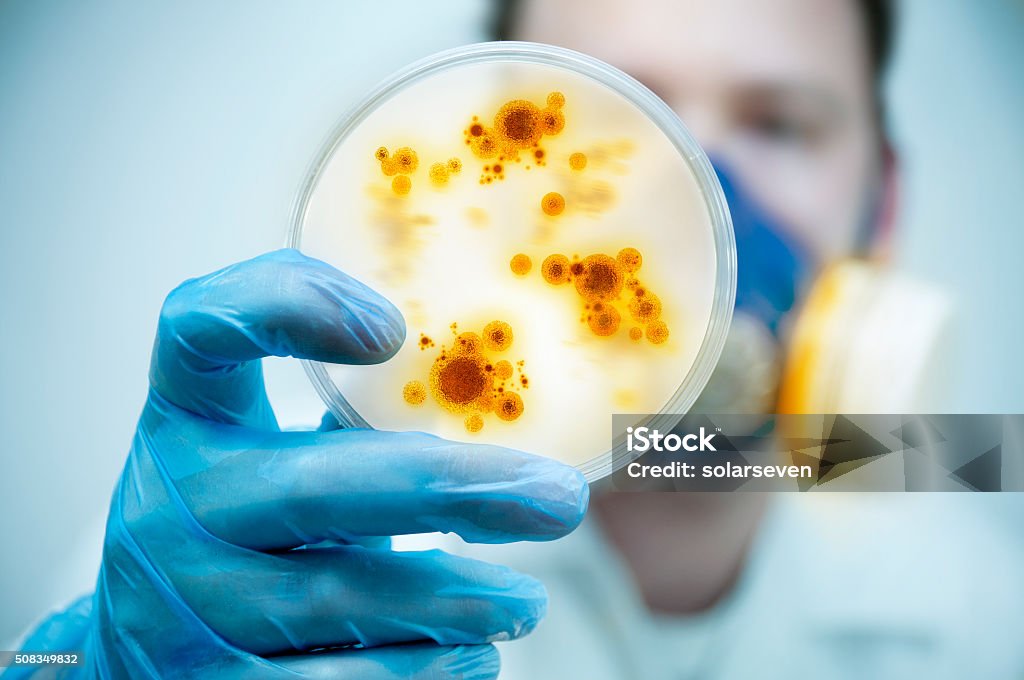 Infection And Disease Control Science and Lab Research.A scientist holding a Petri Dish with Virus and bacteria cells. Infectious Disease Stock Photo