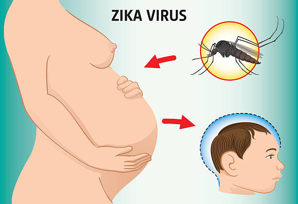 ilustrações, clipart, desenhos animados e ícones de grávida com zika vírus e de doenças com microcefalia bebê recém-nascido, aedes - fetus