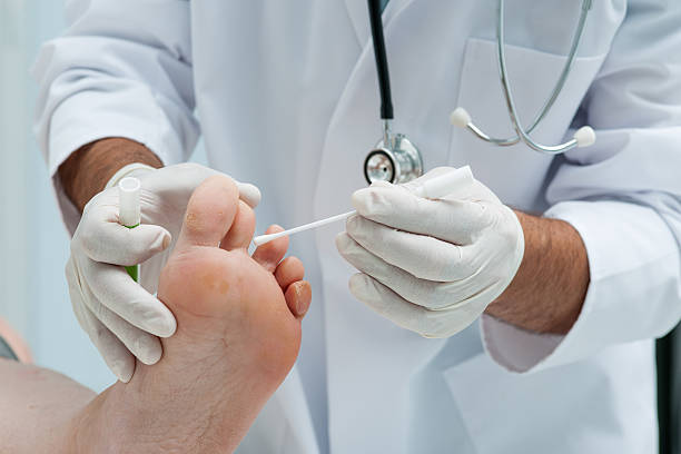 tinia pediküre oder athlete's foot - podiatry chiropody toenail human foot stock-fotos und bilder