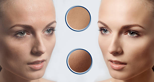Before and after cosmetic operation. Young pretty woman portrait Before and after cosmetic operation. Young pretty woman portrait, isolated on a white background. Before and after cosmetic or plastic procedure, anti-age therapy. examples of perfect skin teenage girl before and after make up stock pictures, royalty-free photos & images