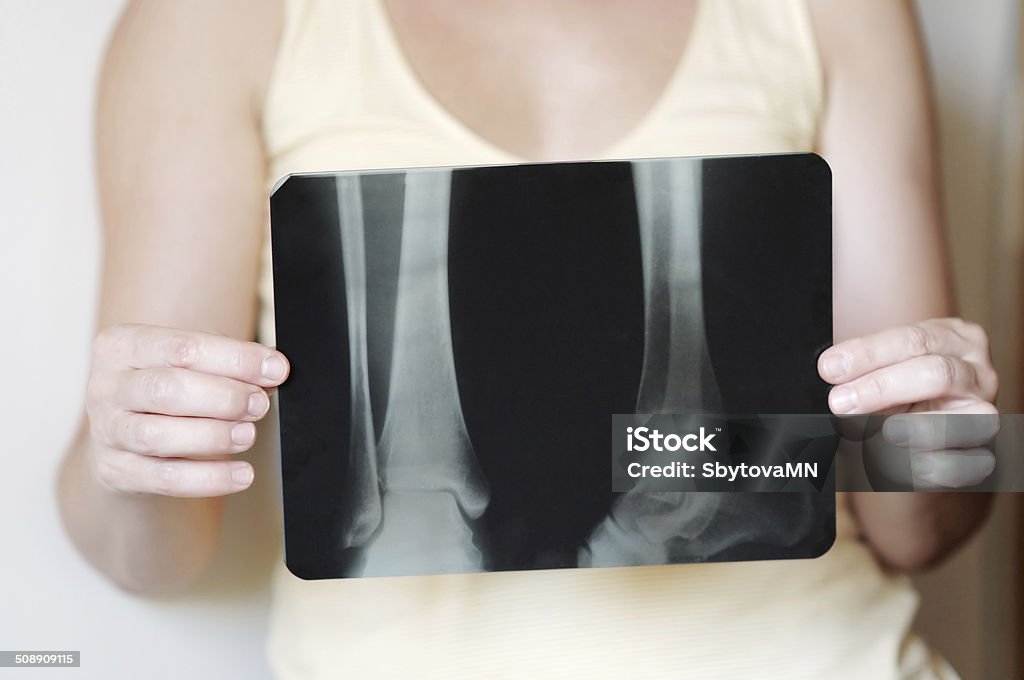 Woman holding an x-ray image Adult Stock Photo